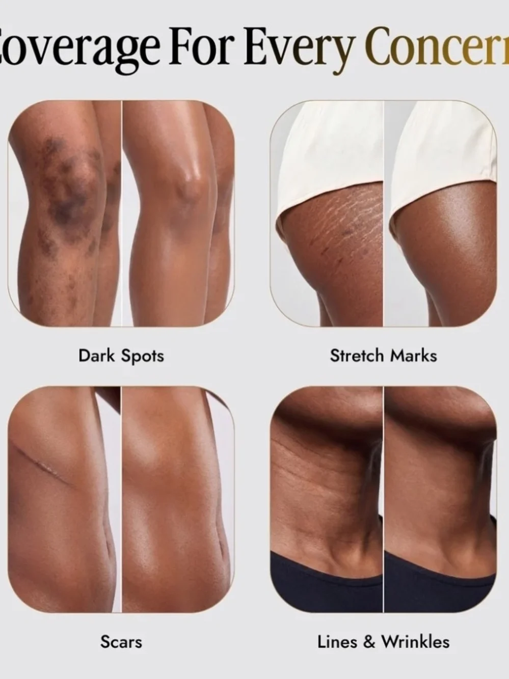 Shimma Body Coverage Cream - Honey Shade